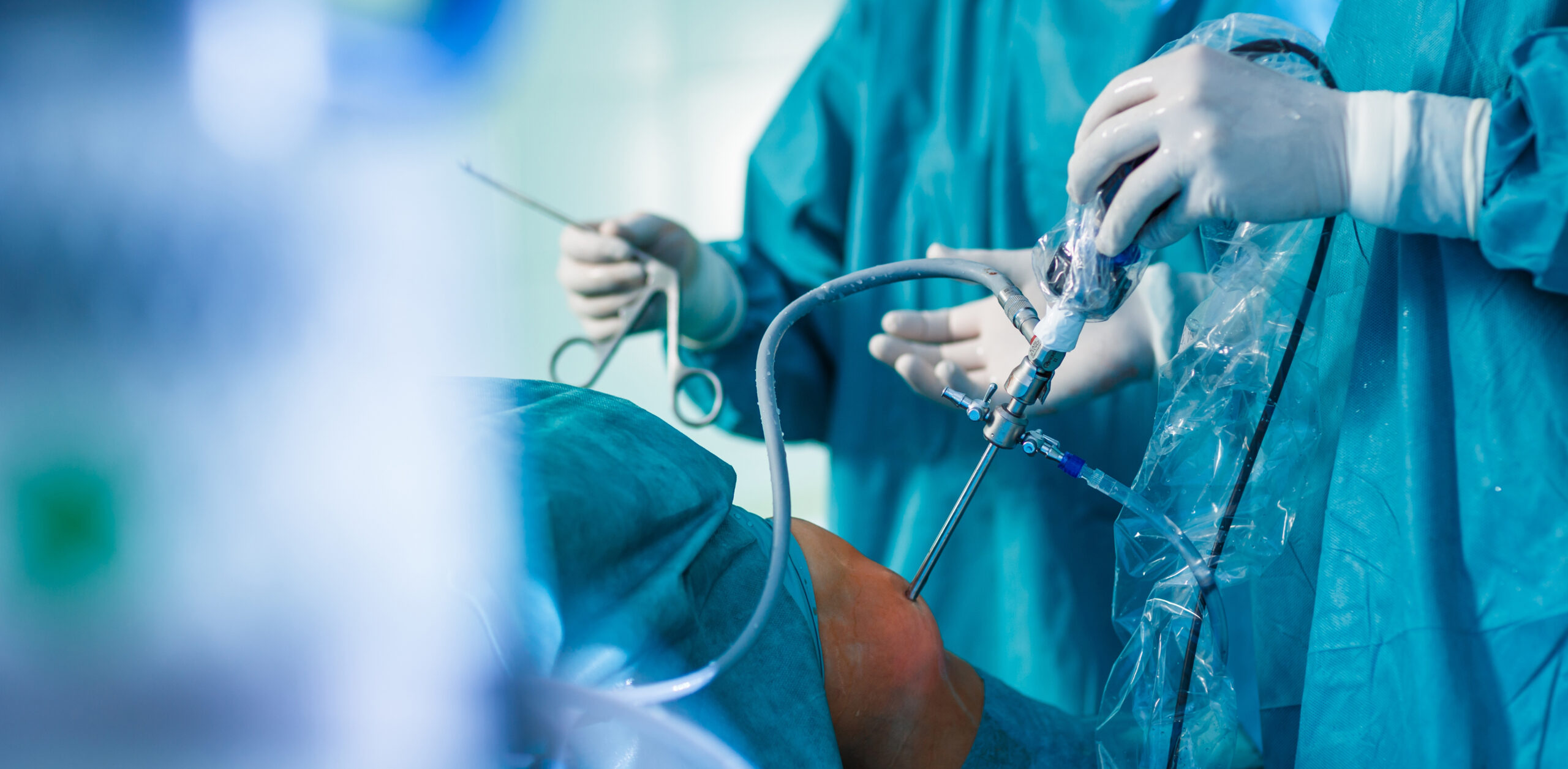 Total Knee Replacement (TKA)
