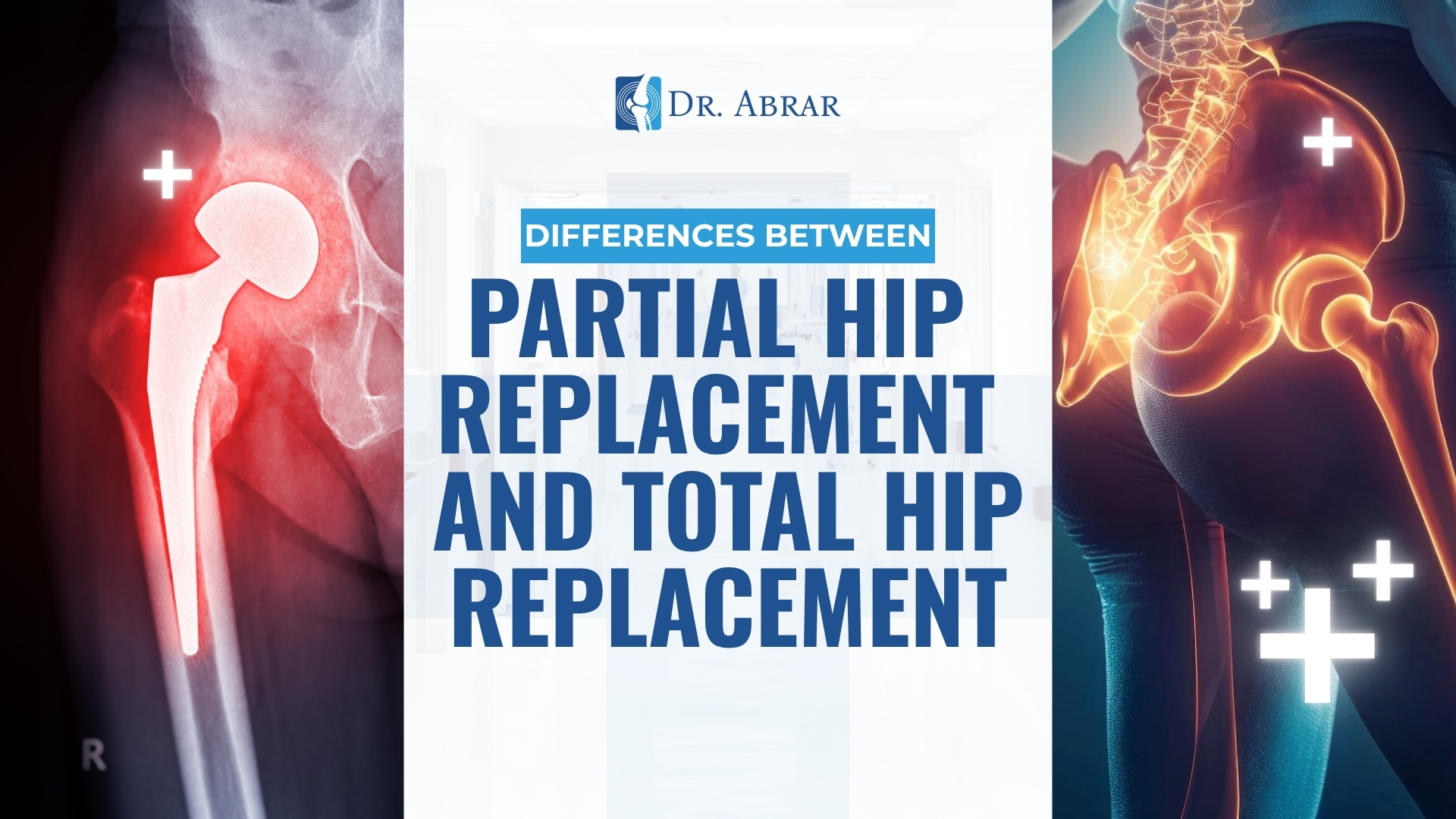 Differences Between Partial Hip Replacement and Total Hip Replacement