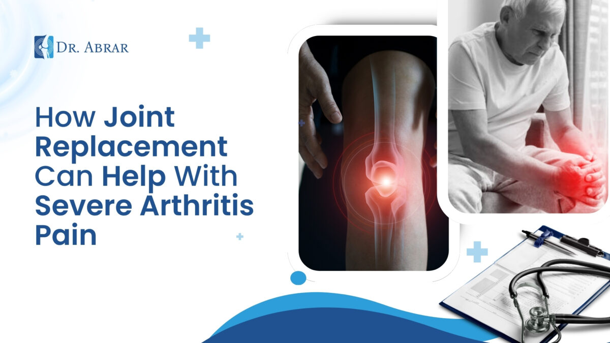 How Joint Replacement Can Help With Severe Arthritis Pain
