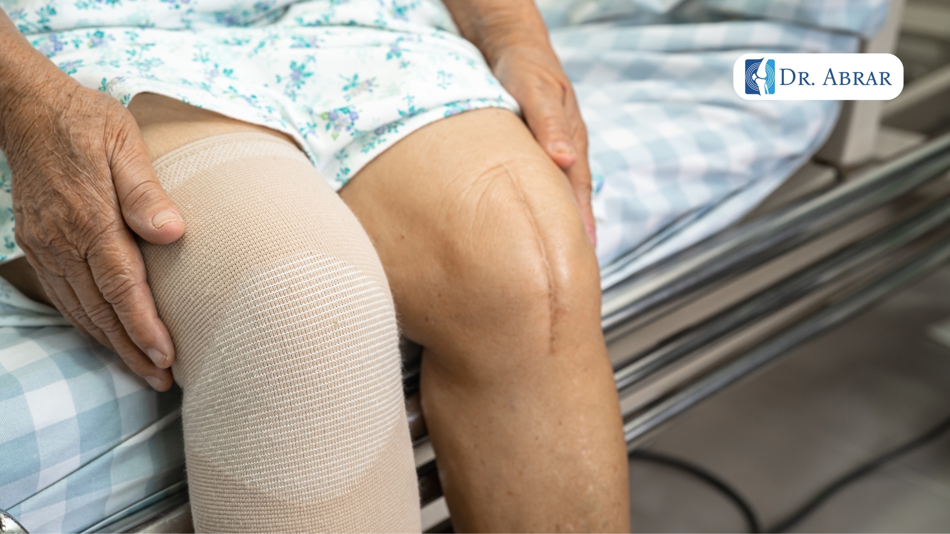 9 Most Common Myths About Knee Replacement Surgery – A Specialist’s Perspective